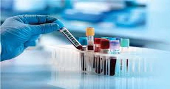 Provision list released for Lab Technician Grade-2 posts