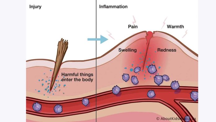Why does swelling occur?