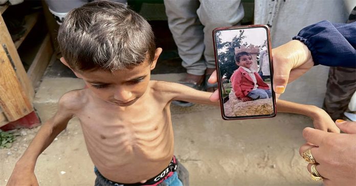 famine in Gaza!