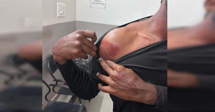 రోడ్లపై పోసిన వరి ధాన్యంతో వాహనదారుడికి గాయాలు.