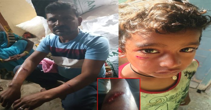 పిచ్చికుక్క దాడి..ముగ్గురికి గాయాలు