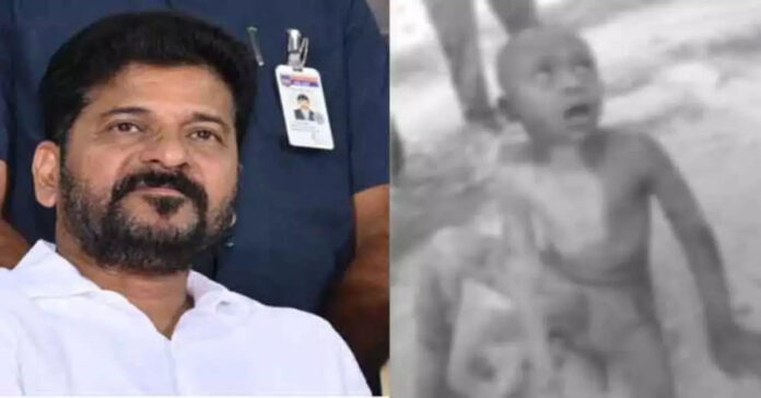 కుక్కల దాడిలో గాయపడిన బాలుడు.. స్పందించిన సీఎం