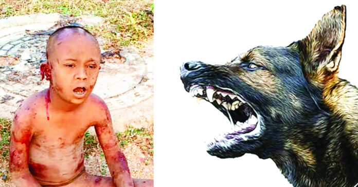 Stray dogs attack mute boy