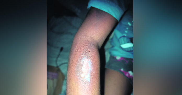 చిన్నారిపై ట్యూషన్ టీచర్ దాష్టీకం