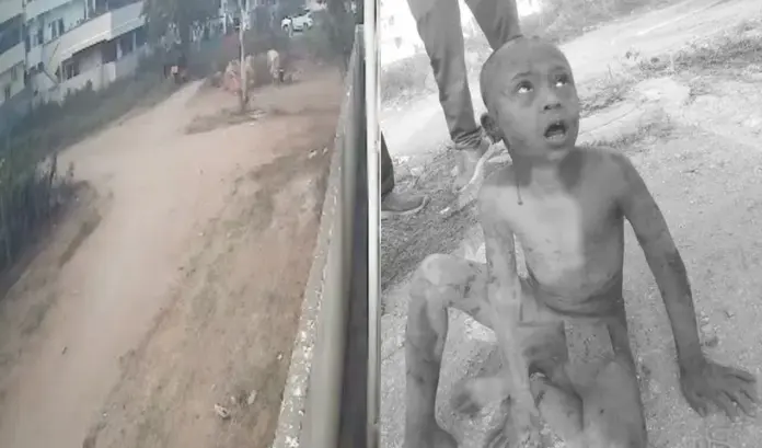 దారుణం..మూగ బాలుడిపై వీధి కుక్కల దాడి