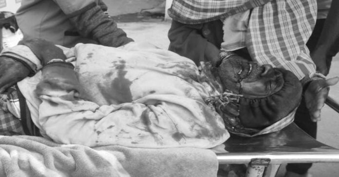 Man seriously injured after being hit by unidentified vehicle