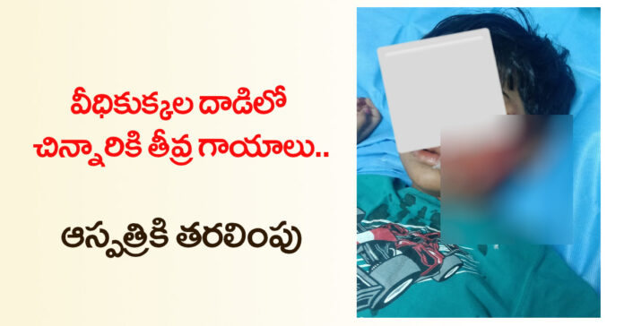 వీధికుక్కల దాడిలో చిన్నారికి గాయాలు
