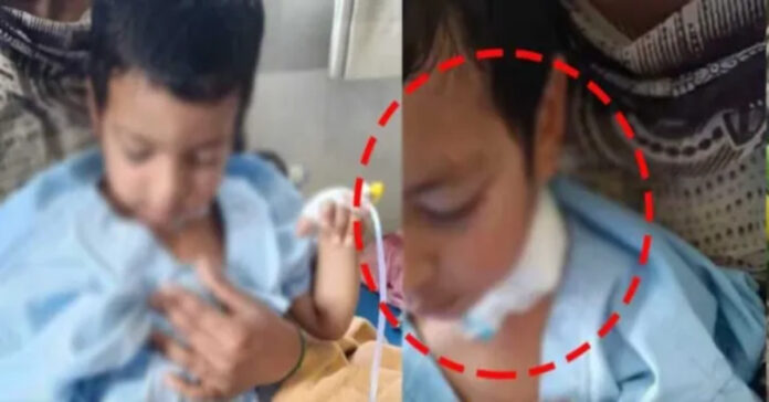 చైనా మాంజా చుట్టుకొని నాలుగేళ్ళ బాలుడికి తీవ్ర గాయాలు