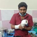 doctor-seriously-injured-after-falling-from-bike