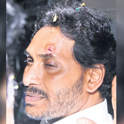 Attack on AP CM Jagan
