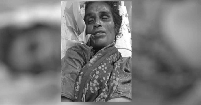 Death of an unidentified woman