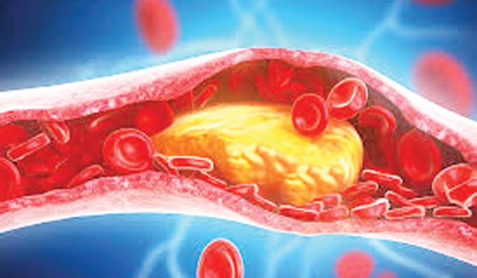 If you want to get rid of bad cholesterol...