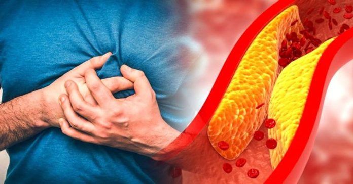 To reduce bad cholesterol...