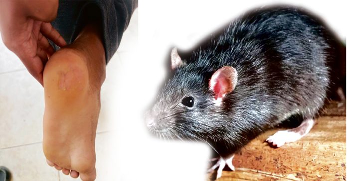 RaTS