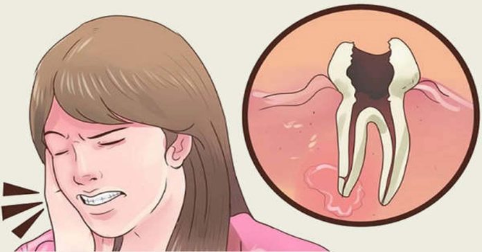 toothache