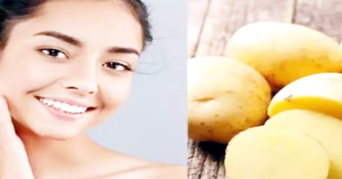 potatoes