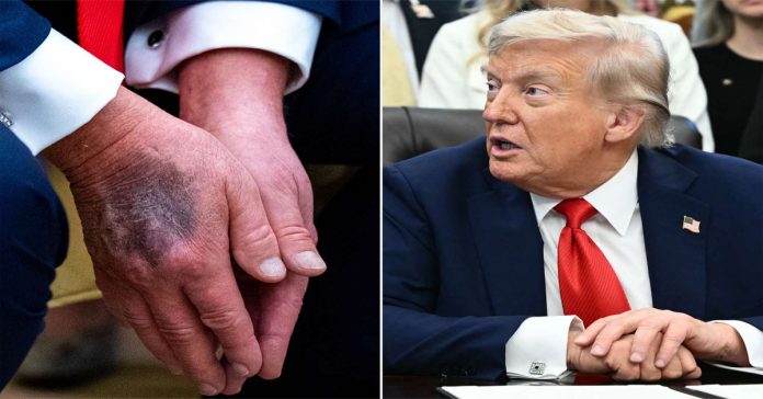trump health