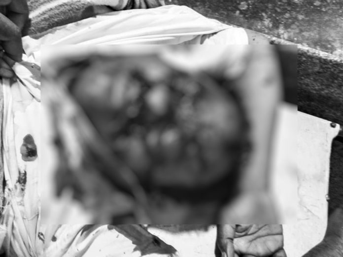 Suspicious death of a person