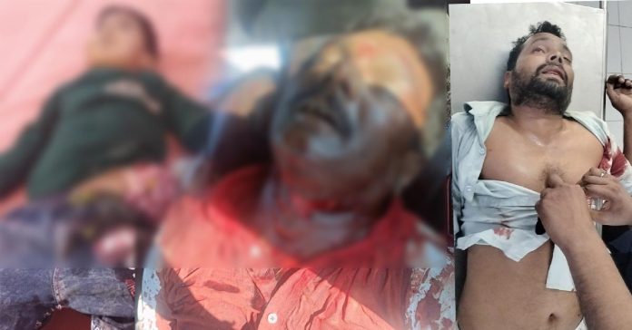 ఆరు నెలల క్రితం బాలుడు మృతి