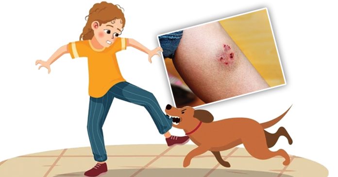 Dog bites are dangerous!!!