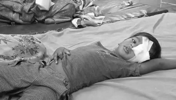 వీధి కుక్కల దాడి..కన్నుకొల్పోయిన చిన్నారి