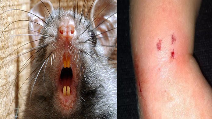 ఏలూరు మెడికల్ కాలేజీ హాస్టల్లో కలకలం..విద్యార్థులపై ఎలుక దాడి