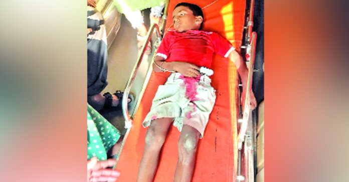 A student died after a pencil got stuck in his throat.