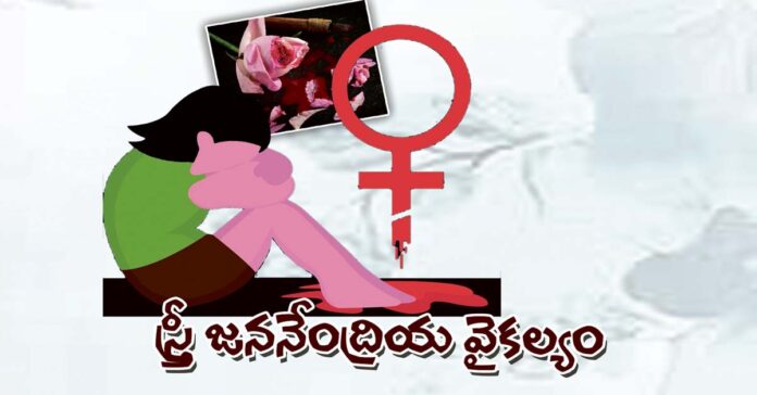 స్త్రీ జననేంద్రియ వైకల్యం