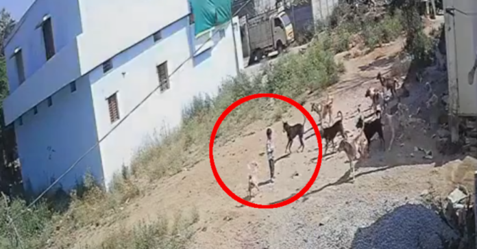 Brutal.. 20 dogs attack a boy