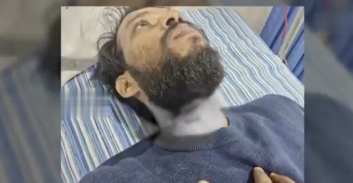 మాంజా వల్ల మరో వ్యక్తి మెడకు గాయం