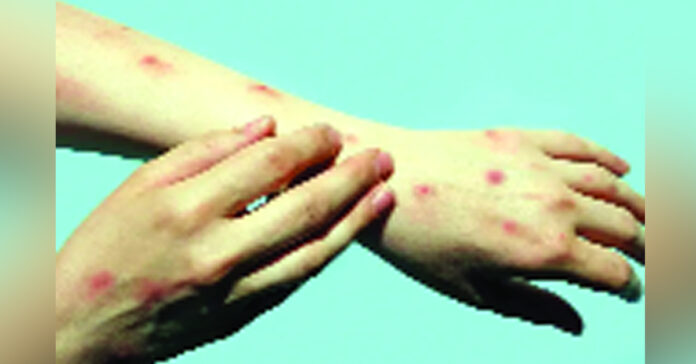 ఈ సమస్యతో బాధపడుతున్నారా?