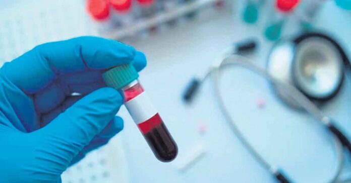 డయాగ్నస్టిక్ పరీక్షలపై నియంత్రణ లేదు