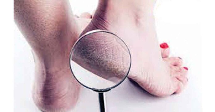 పాదాల రక్షణకు….