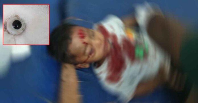 Stray dogs roam freely in Bhuvanagiri