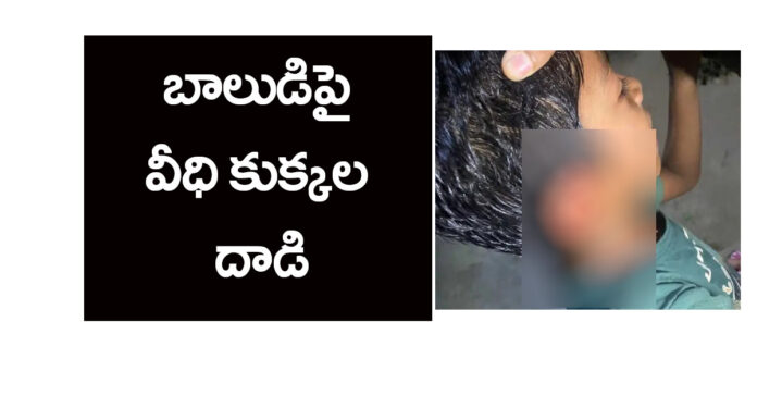 Stray dogs attack boy