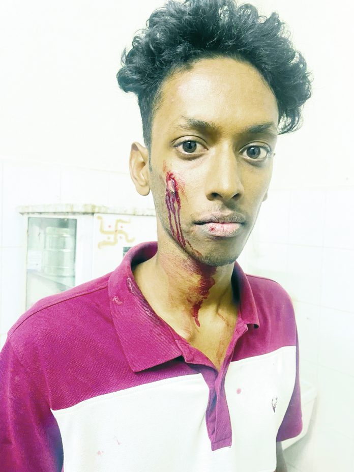 Tension at HCU