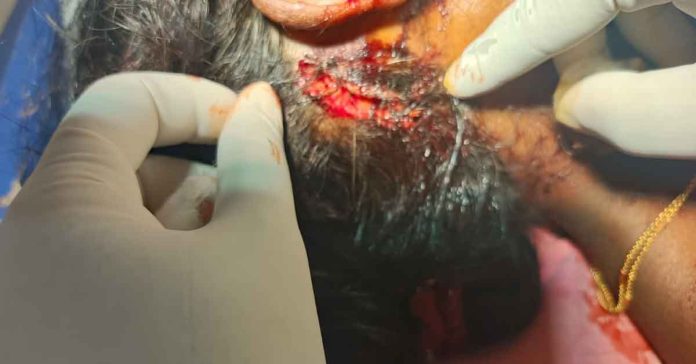 మహిళపై ఎలుగుబంటి దాడి