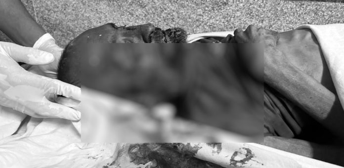 చికిత్స పొందుతూ వ్యక్తి మృతి