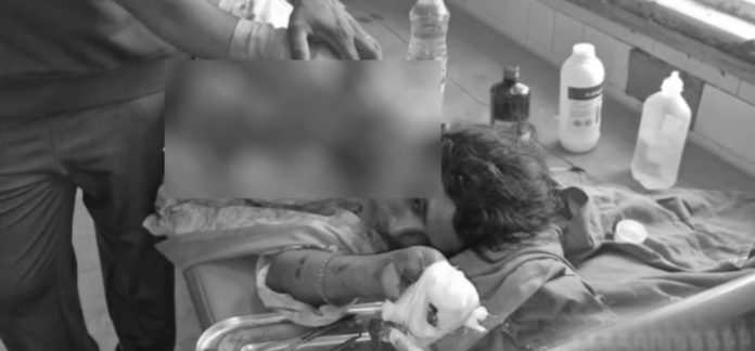 వదినపై గొడ్డలితో దాడి చేసిన మరిది