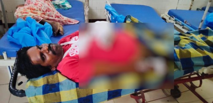 Youth sustains severe injuries in wild boar attack.