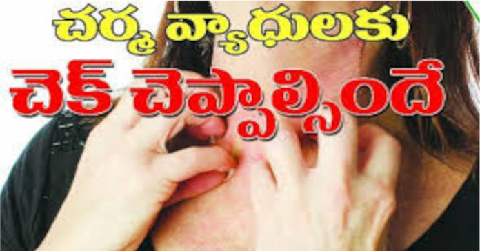 చర్మవ్యాధులు రాకుండా