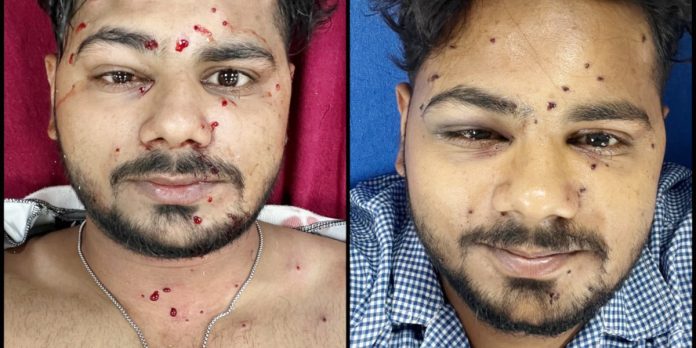 పెల్లెట్ తూటాలా?